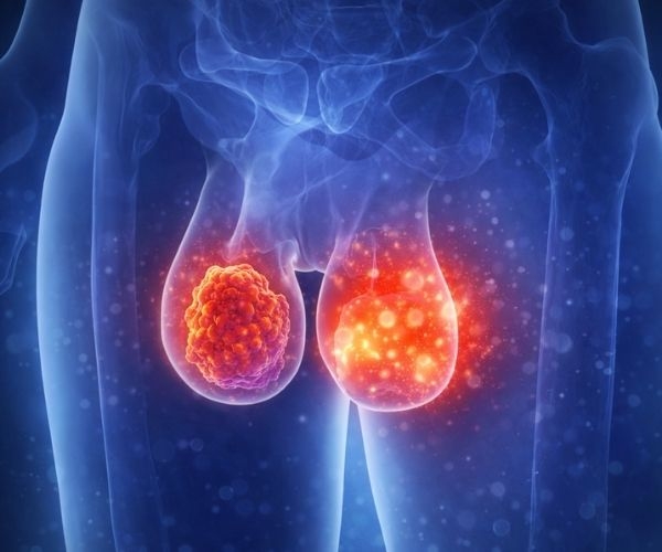 Testicular and Scrotal Diseases